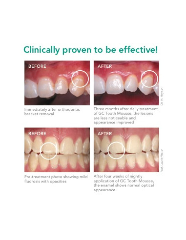 Comprar GC Tooth Mousse Recaldent 40 g | Abanze Dental