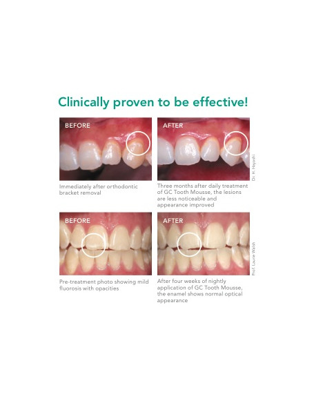 Comprar GC Tooth Mousse Recaldent 40 g | Abanze Dental